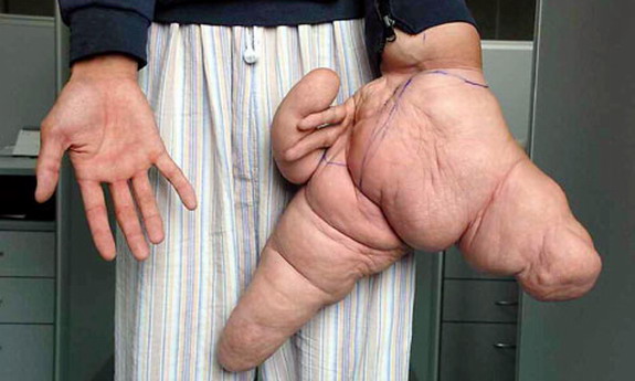 hand